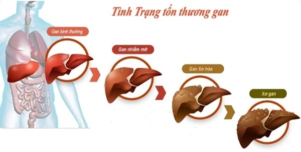 tổn thương gan gây hại tới các bộ phận khác trong cơ thể tổn thương gan gây hại tới các bộ phận khác trong cơ thể